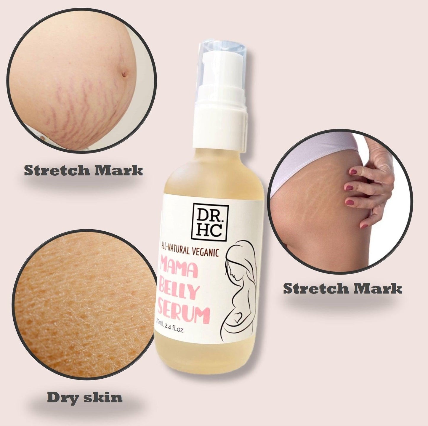 DR.HC All-Natural Veganic Mama Belly Serum (100% Organic, Natural & Vegan) (70ml, 2.4 fl.oz.) (Stretch Mark Removal, Baby Oil...)